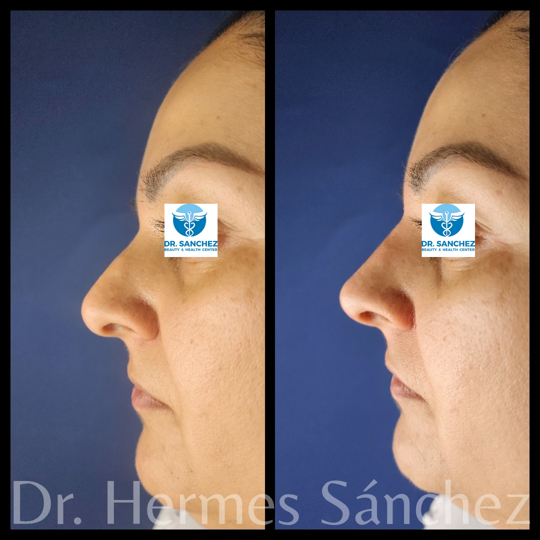 Galería - Transformación 2